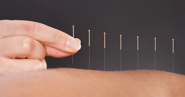 Estudio revela un mecanismo anteriormente desconocido detrás de la capacidad de la acupuntura para reducir el dolor