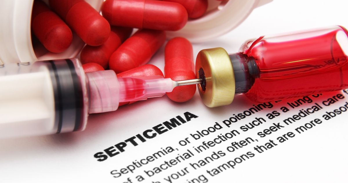 Cómo reconocer los síntomas de la septicemia