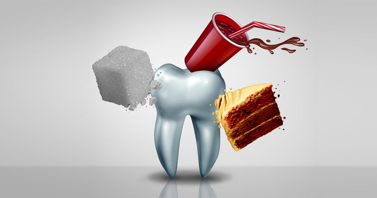 Sodas o tiras blanqueadoras: ¿Cuál es la opción más dañina para sus dientes?
