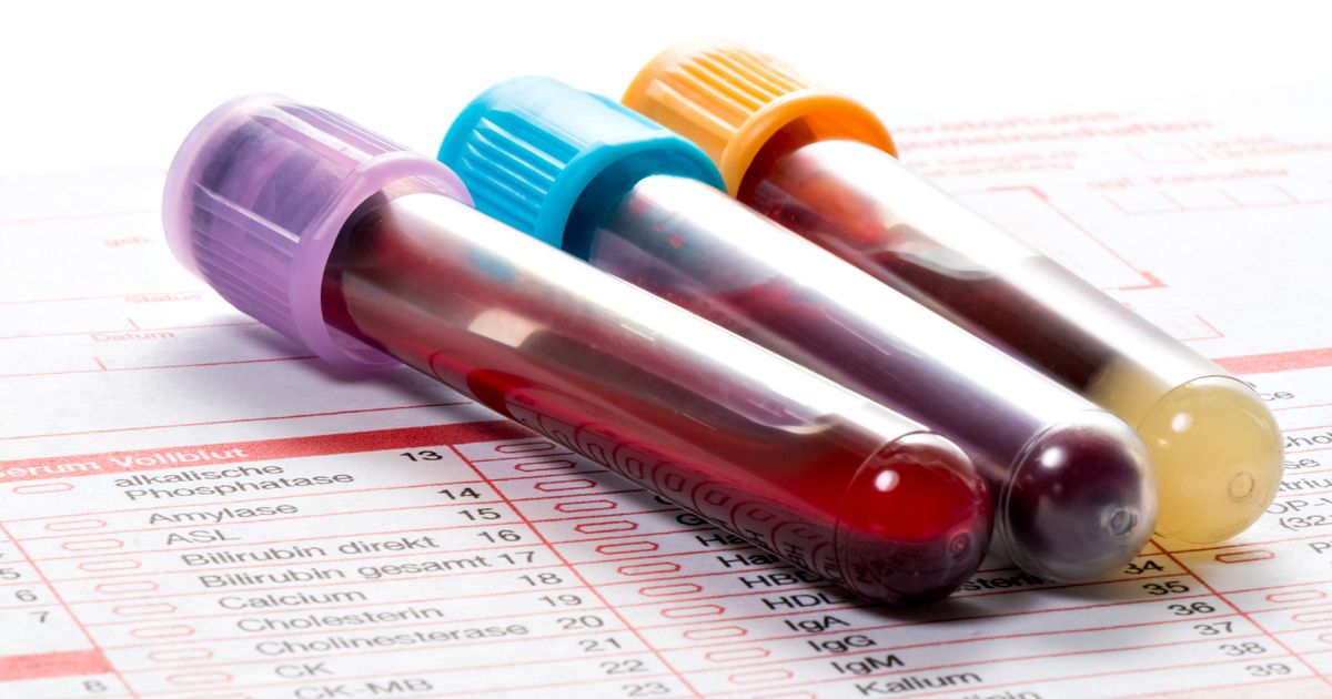 Mercola Responde: ¿Qué debería incluir en su análisis de sangre de rutina?