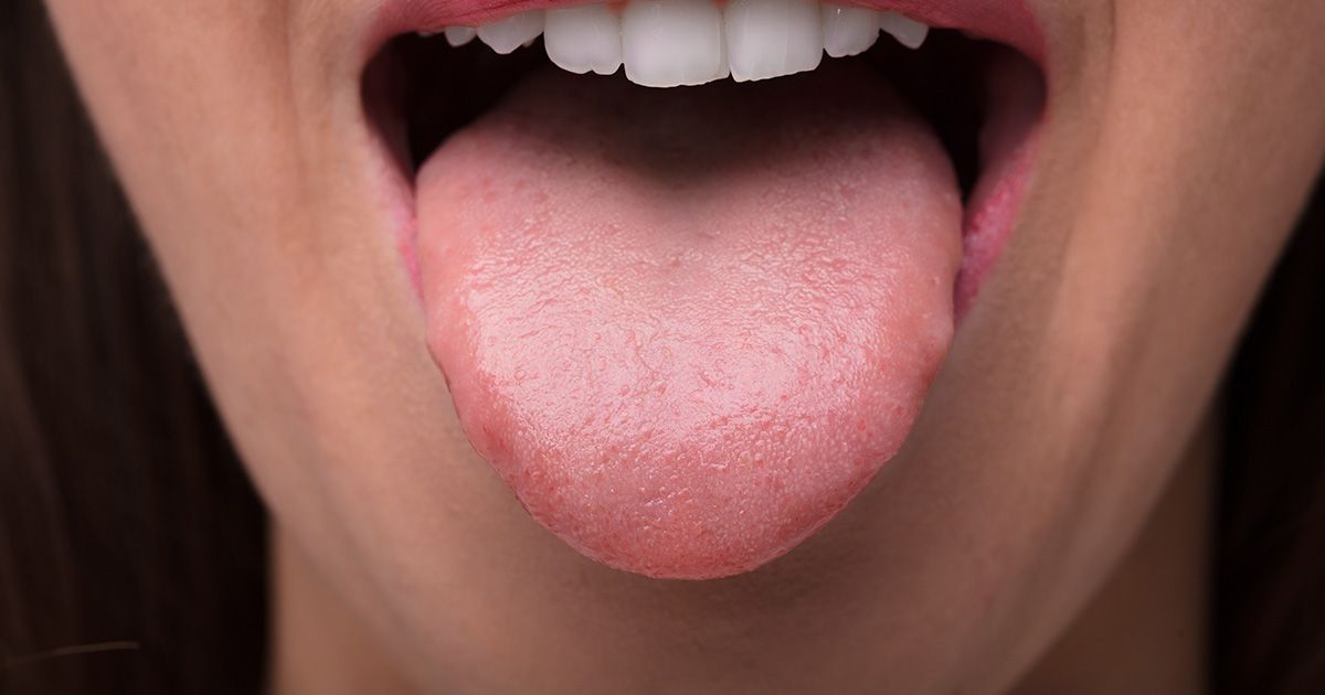 9 datos fascinantes que su lengua podría revelar sobre su salud