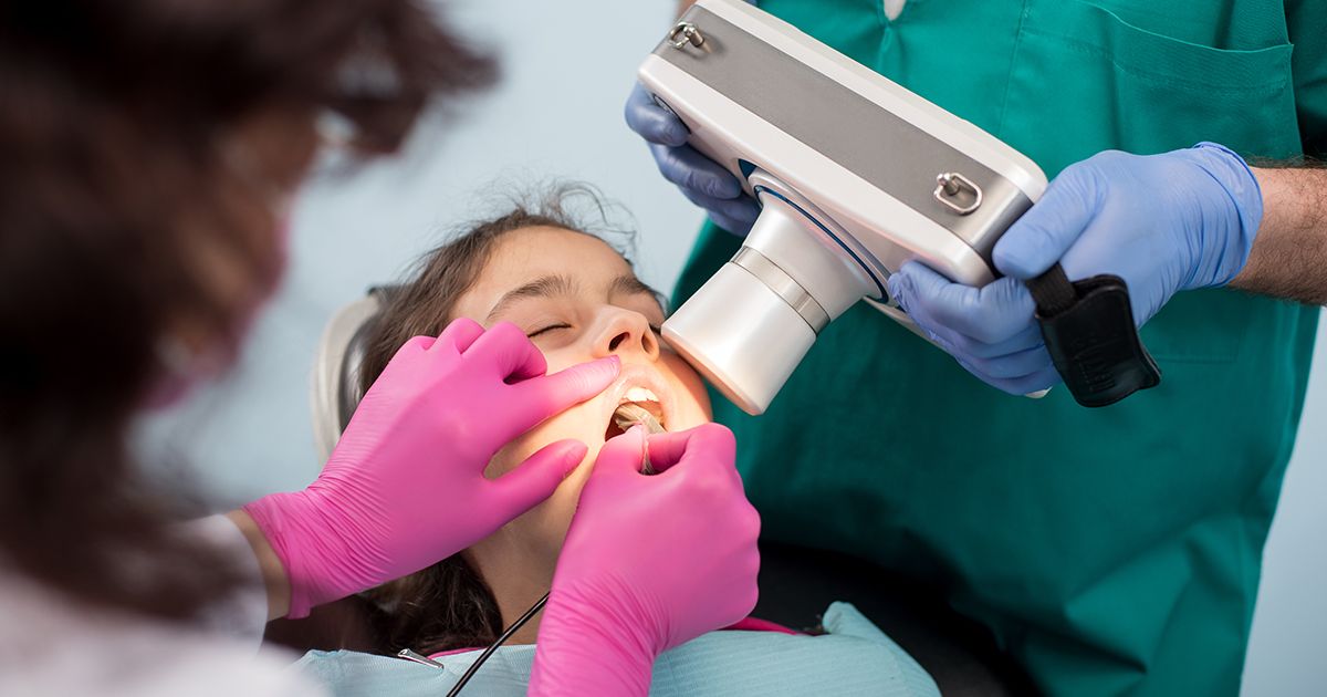 ¿Su hijo debería someterse a una endodoncia?