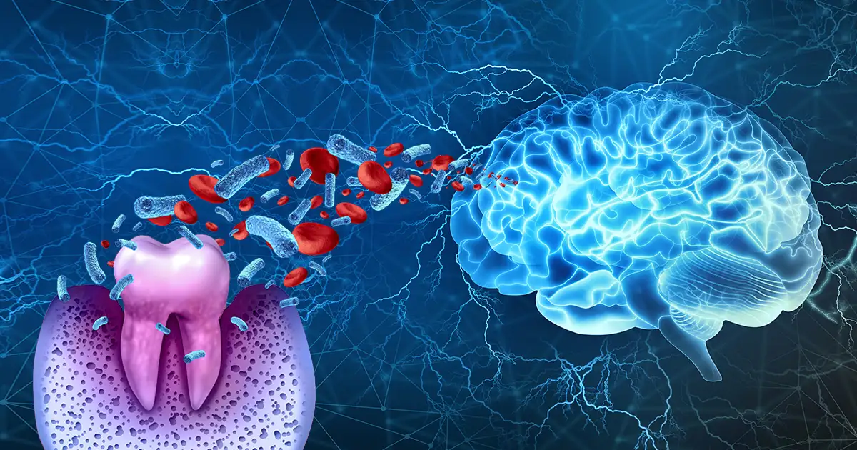 La mala salud bucal podría favorecer esta enfermedad que destruye el cerebro