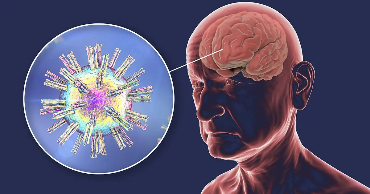 ¿La enfermedad de Alzheimer podría ser infecciosa?