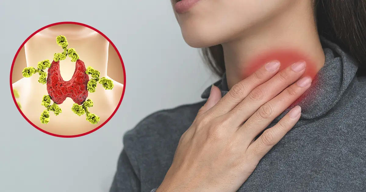 Mercola responde: ¿Qué hacer si tiene la enfermedad de Hashimoto?
