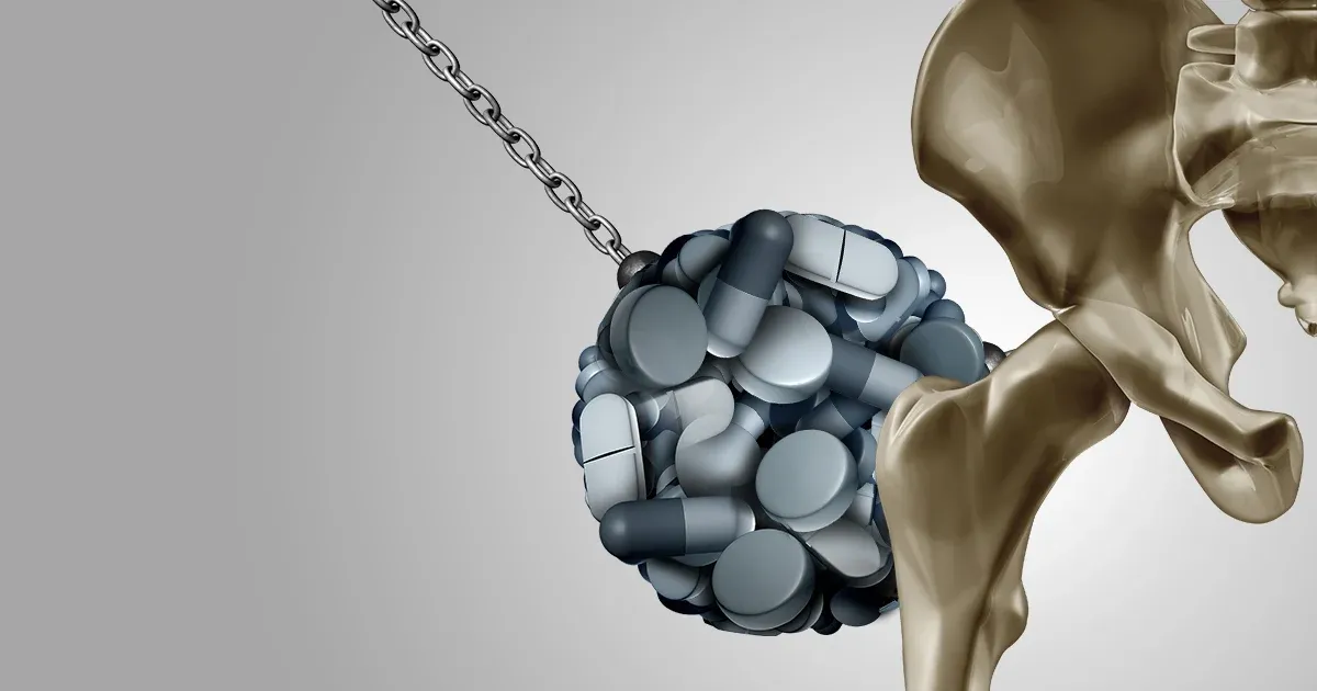 Estos medicamentos podrían dañar sus huesos y causarle osteoporosis sin usted saberlo