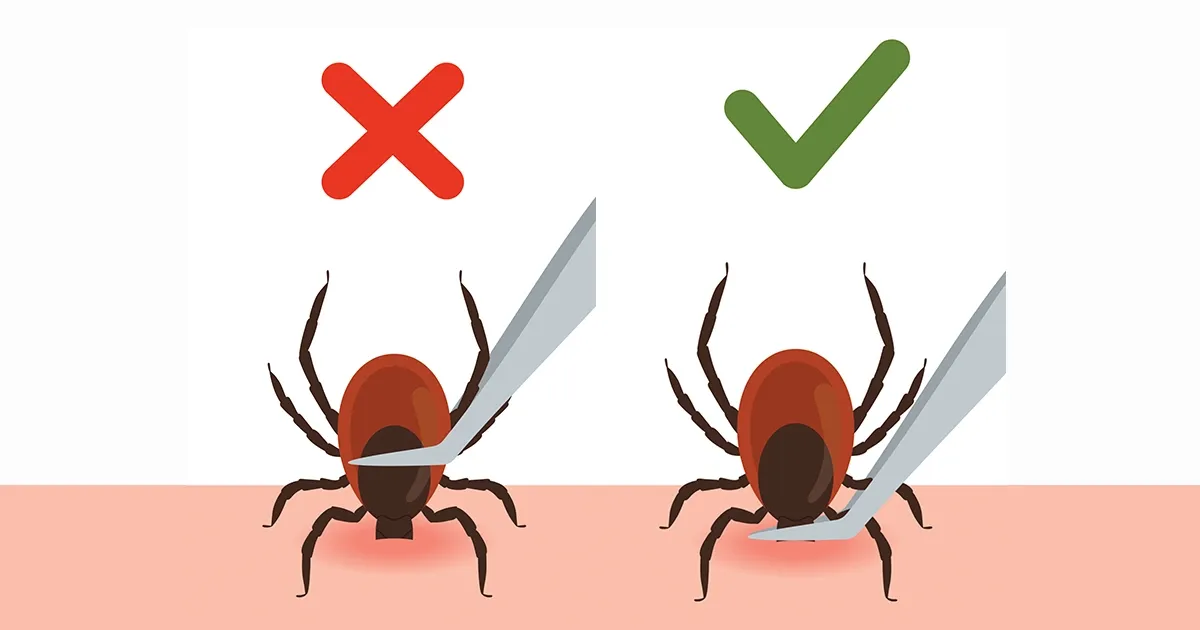 Un mal movimiento al retirar a este invasor podría desencadenar un problema serio de salud