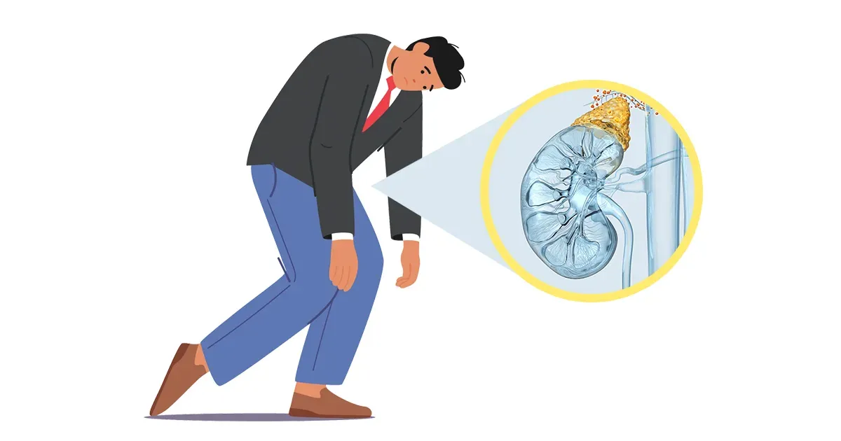 El sorprendente motivo detrás de su agotamiento crónico: no es lo que piensa
