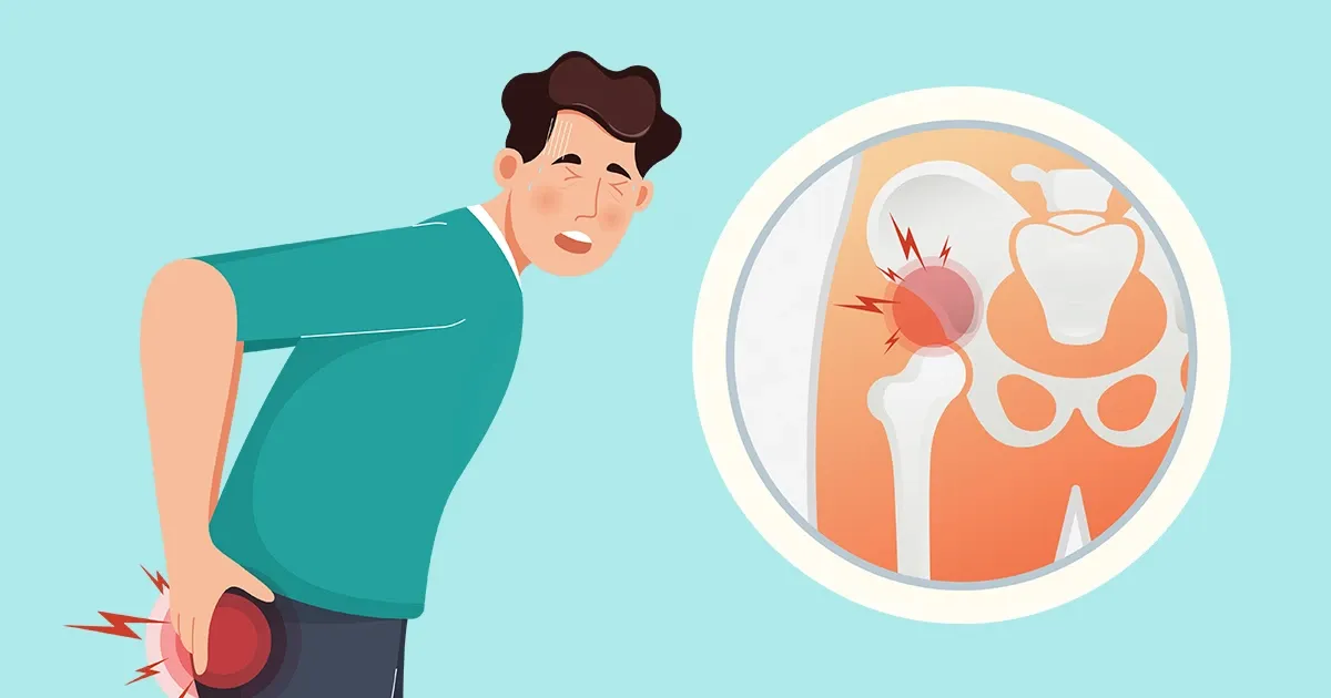 Proyecciones clínicas alertan sobre un fuerte aumento de las fracturas más graves