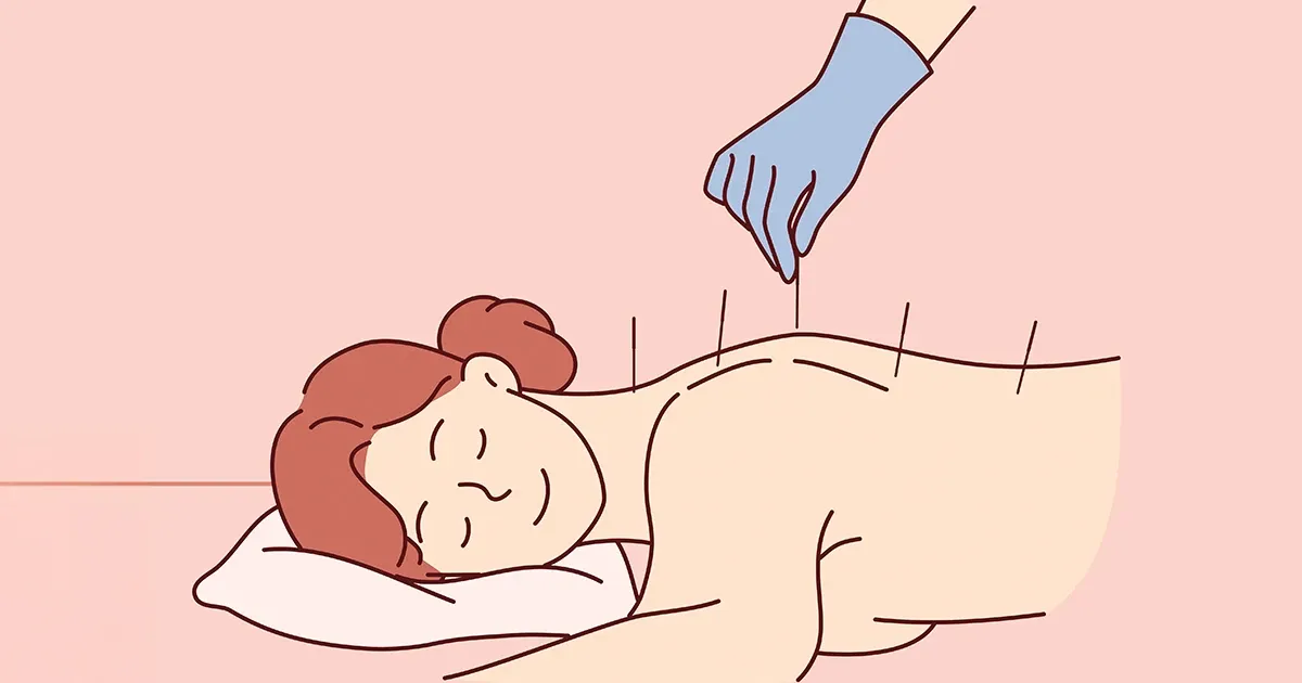 Un enfoque antiguo está sorprendiendo a quienes viven con dolor lumbar persistente