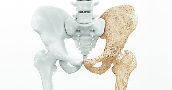 Evite los medicamentos para la osteoporosis, mejor siga estas estrategias