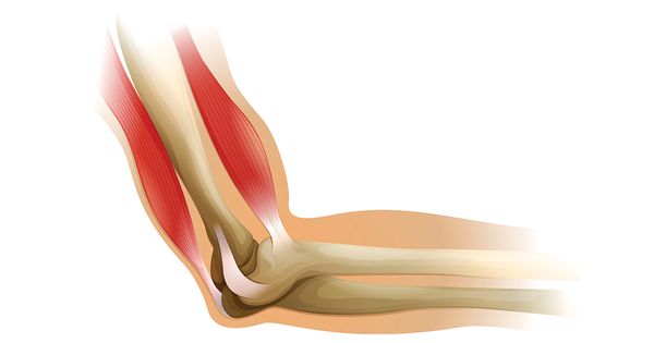 El deterioro muscular es una alerta de salud muy grave