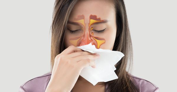 El color de su mucosidad nasal podría decir mucho sobre su salud