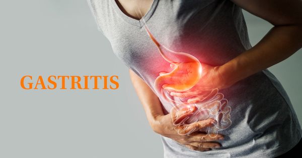 Mercola responde: ¿Qué es la gastritis y cómo tratarla?