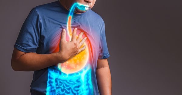 Mercola responde: ¿Cómo aliviar el reflujo ácido y la acidez estomacal de forma natural?