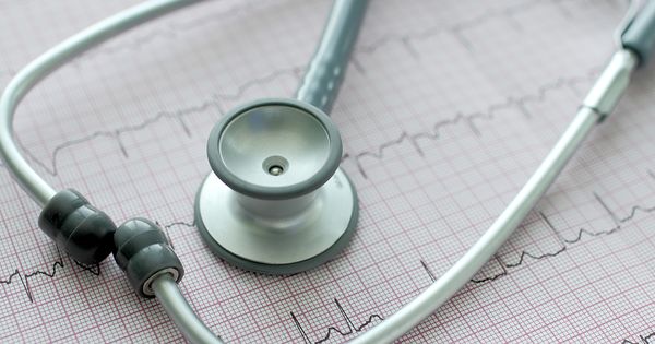 Cómo identificar la fibrilación auricular y qué hacer al respecto