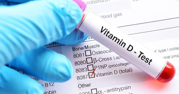 Cómo la prueba de desempeño de la vitamina D podría ayudarle a optimizar su salud