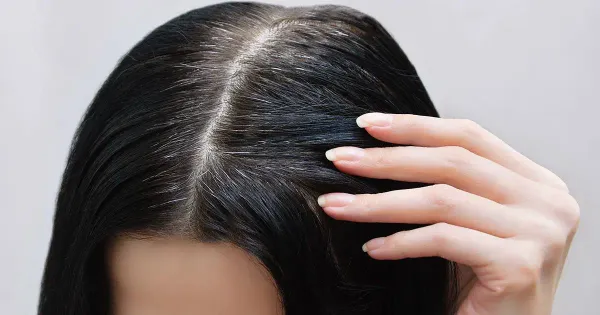 ¿Por qué salen las canas?