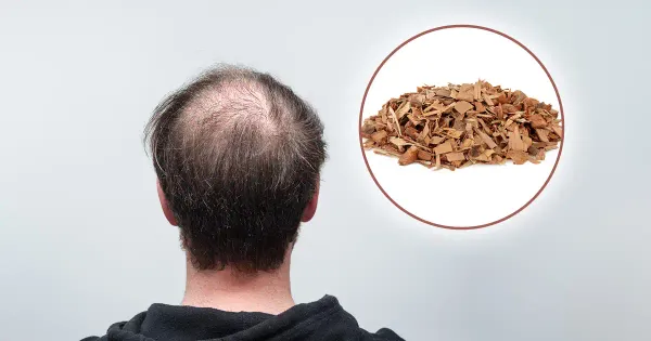 ¿Podría la palma enana americana ayudar con la pérdida del cabello?