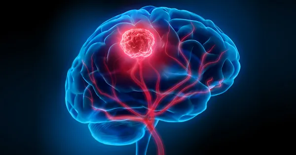 Los síntomas más comunes de esta temible enfermedad cerebral
