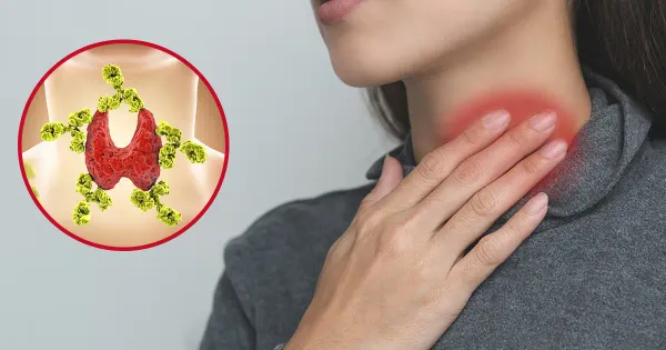 Mercola responde: ¿Qué hacer si tiene la enfermedad de Hashimoto?
