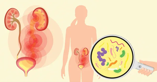 Comer este tipo de carne puede causar una infección del tracto urinario