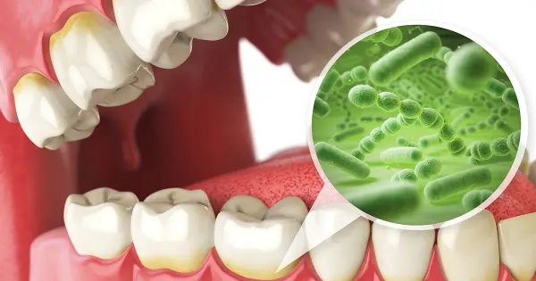 ¡No descuide su salud oral! Estas bacterias en su boca podrían provocarle trastornos neurológicos