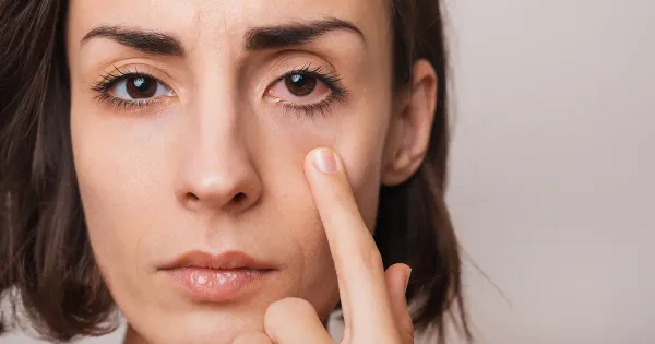 Remedios naturales para prevenir ojos secos