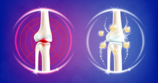 El superalimento que podría salvar sus articulaciones de la osteoartritis