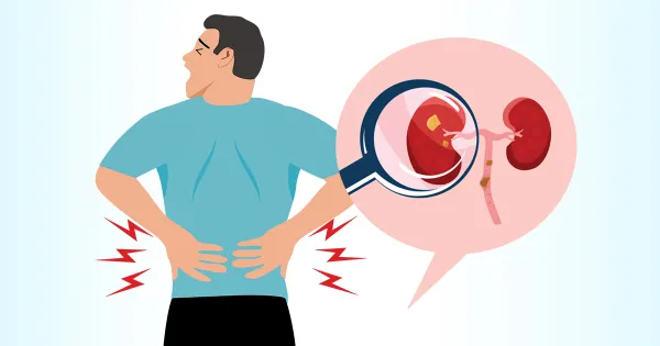 ¿Este desajuste biológico está alterando el equilibrio de su salud renal?