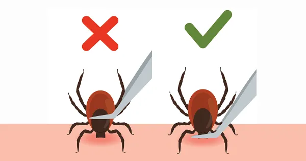 Un mal movimiento al retirar a este invasor podría desencadenar un problema serio de salud