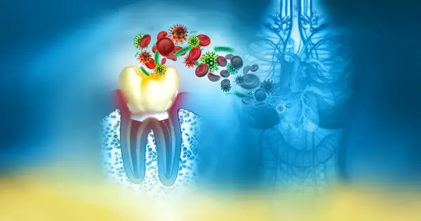 Habita en sus encías y se relaciona con una enfermedad del corazón: elimine esta bacteria de su boca ahora
