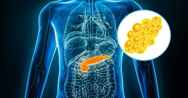Esta grasa “fantasma” está afectando su capacidad cognitiva