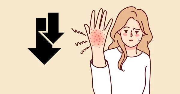 Cuando dos hormonas caen, la inflamación toma el control de su piel