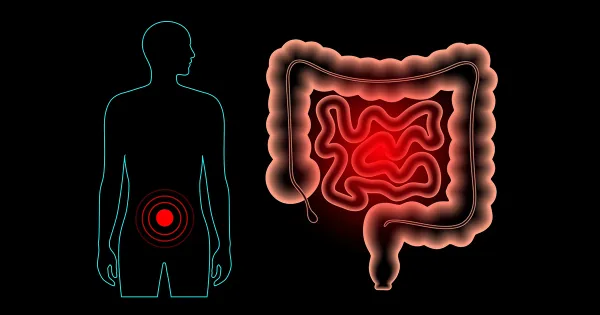 El “interruptor mental” que puede amplificar el dolor intestinal